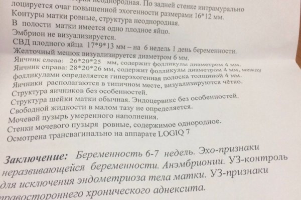 Кракен ссылка на тор официальная онион